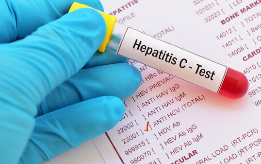 Hepatitis C virus (HCV) test