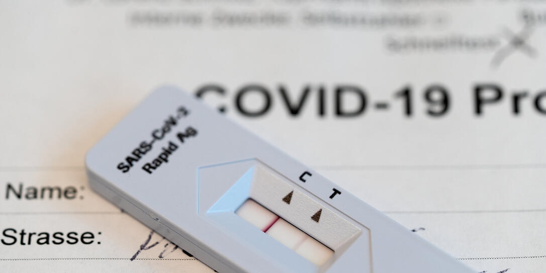 SCHNELLTEST, ANTIGEN-SCHNELLTEST, CORONA-SCHNELLTEST, COVID-19 SCHNELLTEST, TEST, SARS-COV-2 RAPID ANTIGEN TEST,  CORONAVIRUS, VIRUS, COVID-19, COVID 19, SARS-COV-2, NCOV-2019, 2019-N-COV,  TESTRESULTAT, TESTSTREIFEN, POSITIV,   NASEN-RACHEN-ABSTRICH,