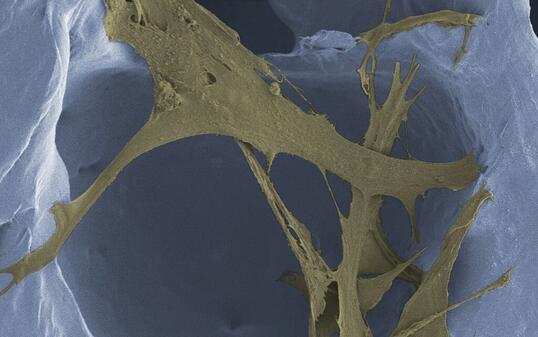 Im Gerüst des Polymerschaums finden Zellen - wie diese Fibroblasten - guten Halt, um neues Hautgewebe aufzubauen. 
(Kolorierte Mikroskopaufnahme, Vergrösserung 1200-fach)